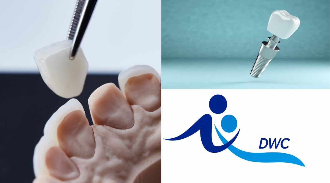 Dental Crowns & Implants